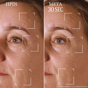 Immortelle Divine Targeted Wrinkle Care